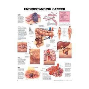 1587793571 PT# 1587793571  Chart Anatomical Understanding Skin Cancer 